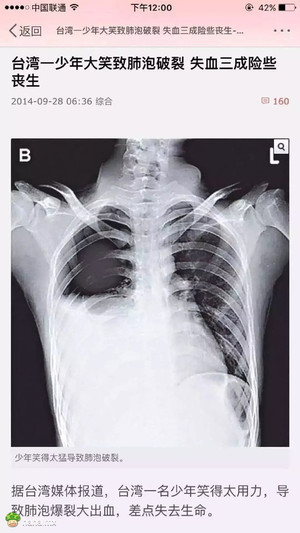 请珍惜身边爱笑的人 也许他们哪天笑着笑着就死了