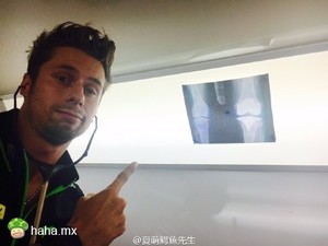 雅马哈Tech 3车手Bradley smith伤后拍的X光片，好屌
