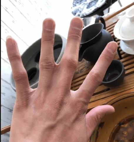 请问这还能怎么办