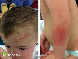 5岁男童把自己反锁烘干机内 泰迪狗狂叫助其获救