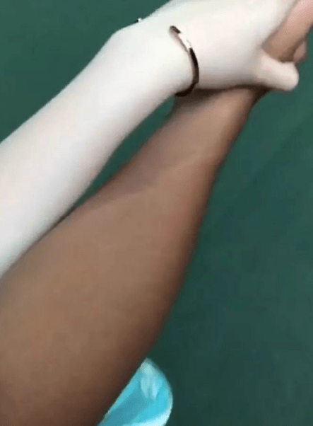 夏天最显白的方法