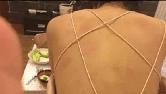 妹子的衣服很个性，就是蚊子有点多，背上都是红印子。